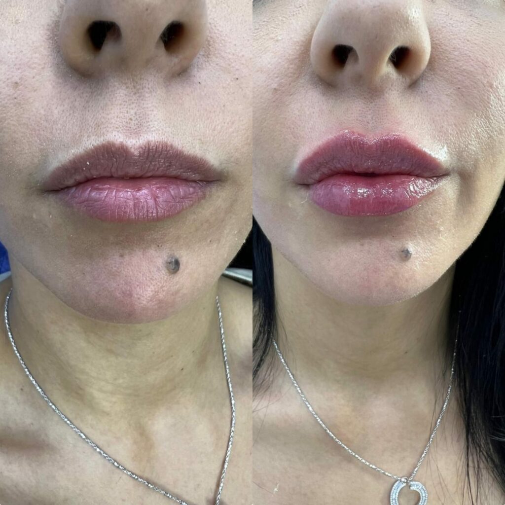 تجميل وعناية بالشفايف